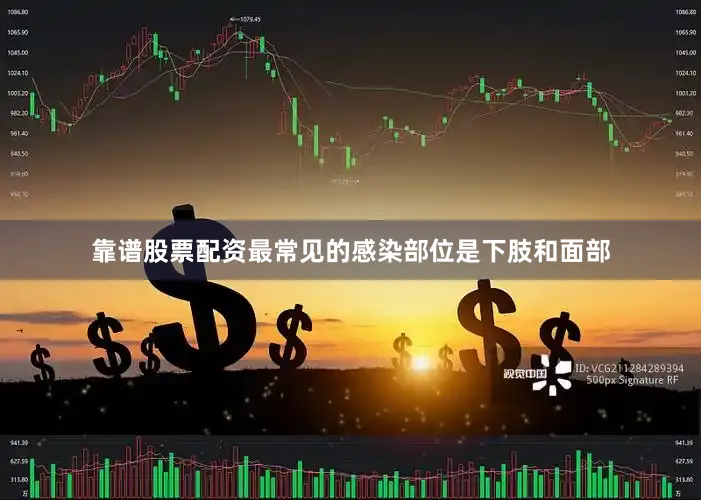 靠谱股票配资最常见的感染部位是下肢和面部